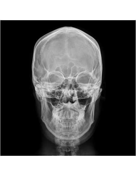 Coogie 2nd Album - UPSET CD